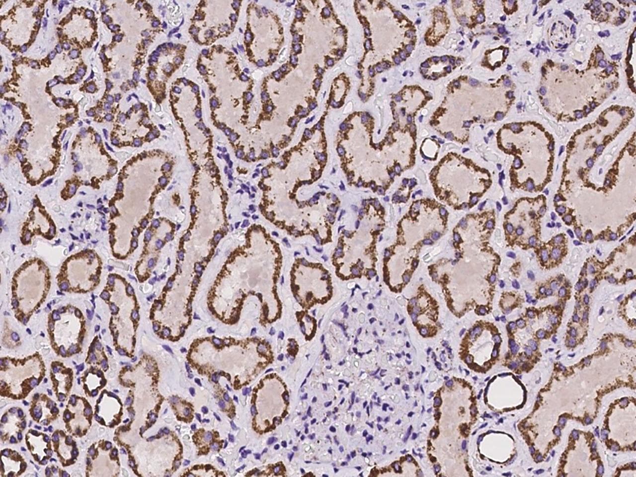 Polyclonal Rabbit anti-Human ANKRD33B Antibody (IHC, IF)