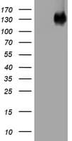 Monoclonal Mouse anti-Human EGFR Antibody (clone OTI1E5, aa900-1210, WB)