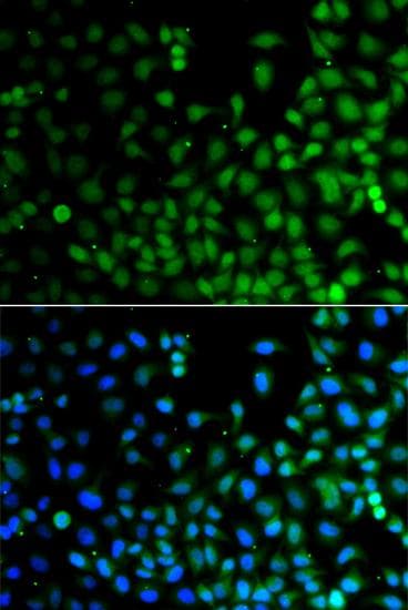 LHX6 Antibody