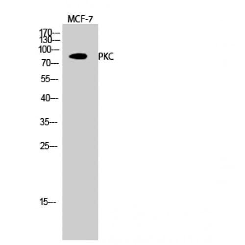 PKC / Protein Kinase C Antibody (600-680 aa)