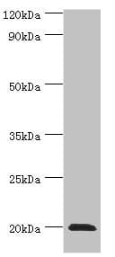 HSPB2 / HSP27 Antibody (aa1-182)