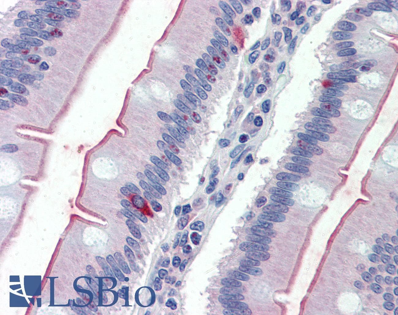 IHC-plus™ Polyclonal Rabbit anti-Human SLC5A1 / SGLT1 Antibody (Internal, IHC)
