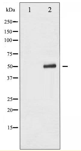 TP53 / p53 Antibody (phospho-Ser315)