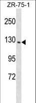 PITPNM1 / NIR2 Antibody (aa143-171)