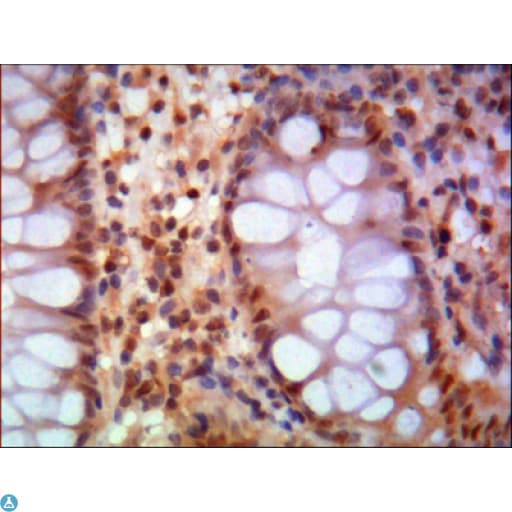 SMC1A / SMC1 Antibody