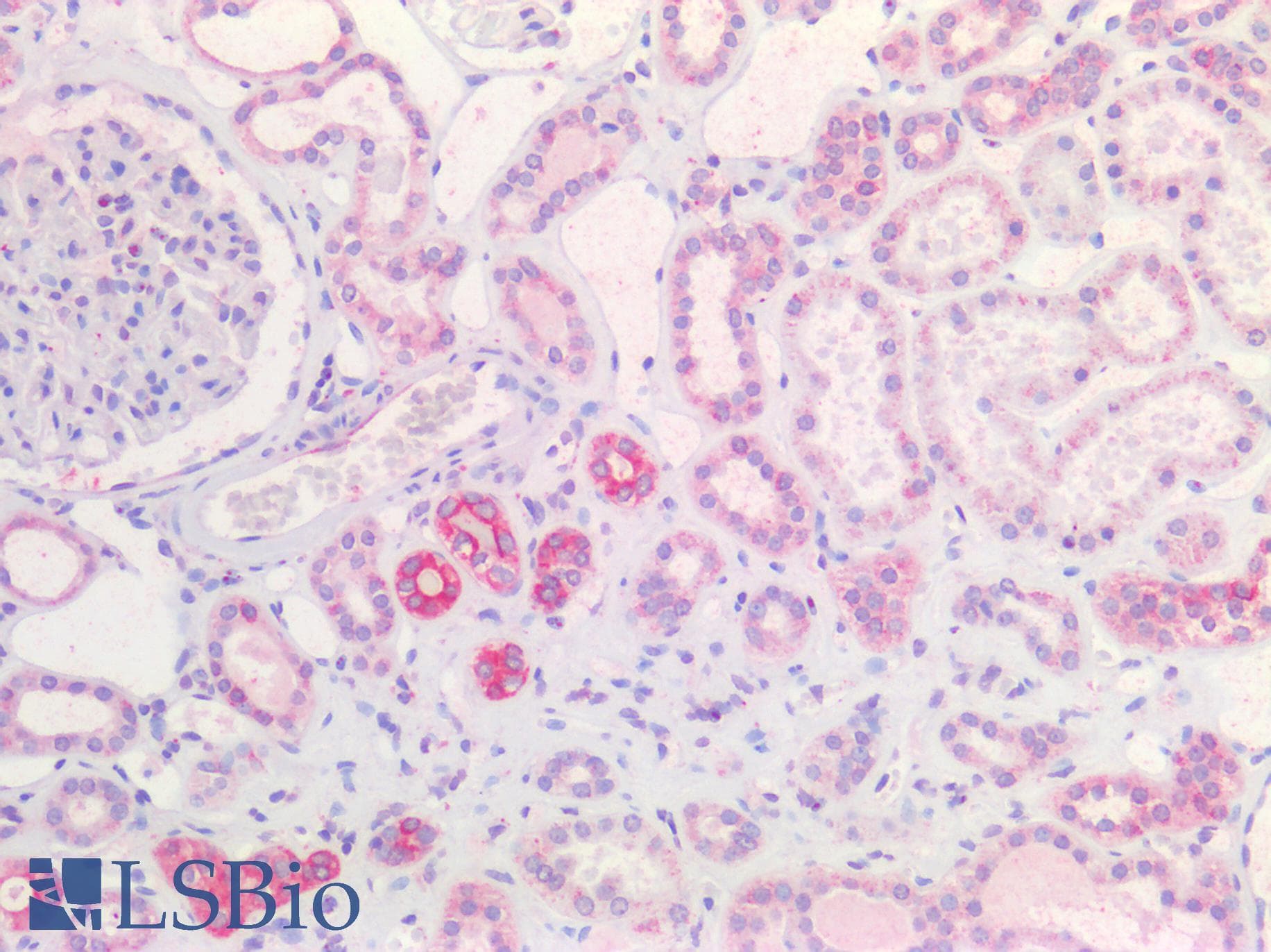 PathPlus™ IGF2 Antibody (aa81-93)
