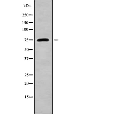 Polyclonal Rabbit anti-Human GPSM1 / AGS3 Antibody (IHC, WB)