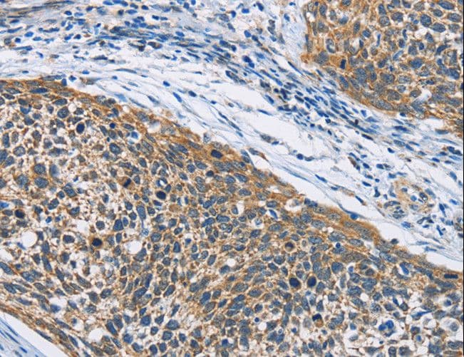 Polyclonal Rabbit anti-Human HDAC6 Antibody (IHC)