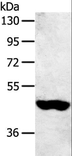 SULT2B1 / Sulfotransferase 2B1 Antibody