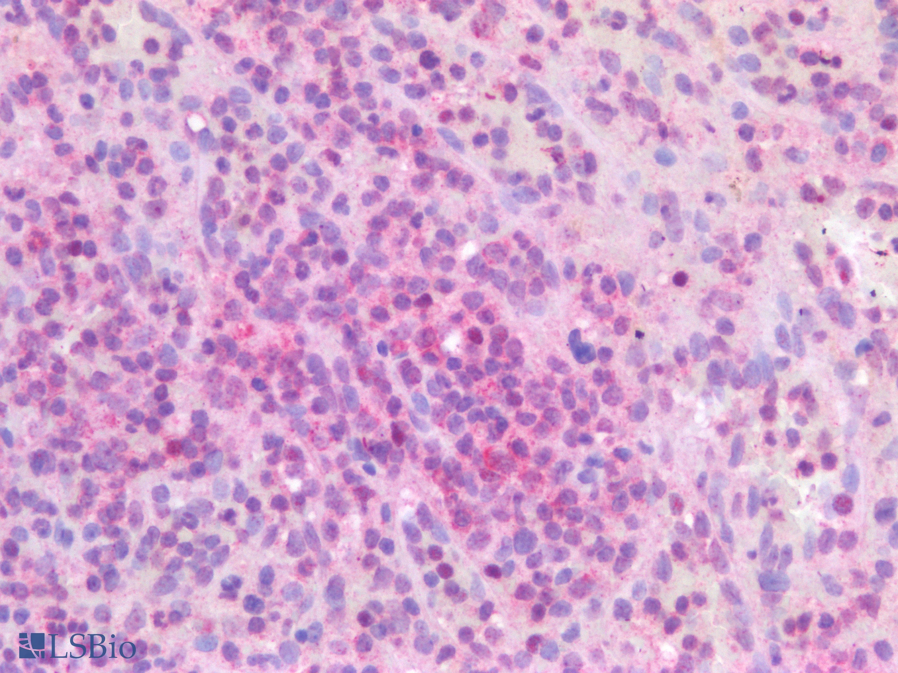 IHC-plus™ TSLP Antibody