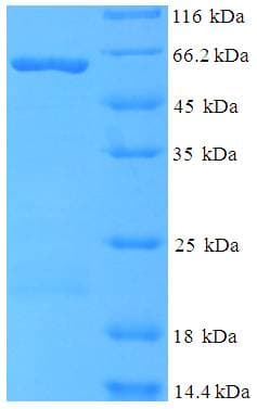 Human CCBL1 Protein (Recombinant His-SUMO)
