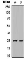 IHC-plus™ C1QL3 Antibody (Internal)