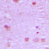 Polyclonal Rabbit anti-Human NCOA7 Antibody (Internal, IHC, WB)