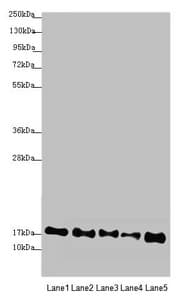 ATP5D Antibody