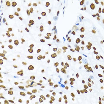 KHDRBS1 / SAM68 Antibody