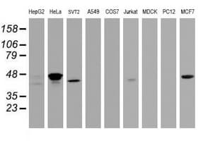 CBX8 Antibody (clone OTI1C7)