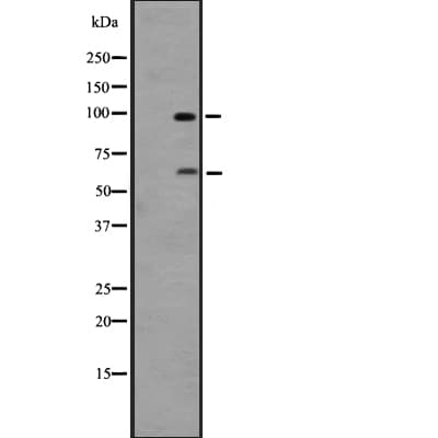 ADGRD1 / GPR133 Antibody