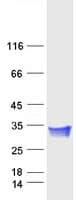 Human CTHRC1 Protein (Recombinant Myc-DDK (Flag))