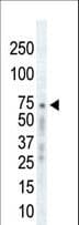 ADRBK1 / GRK2 Antibody (aa633-660)
