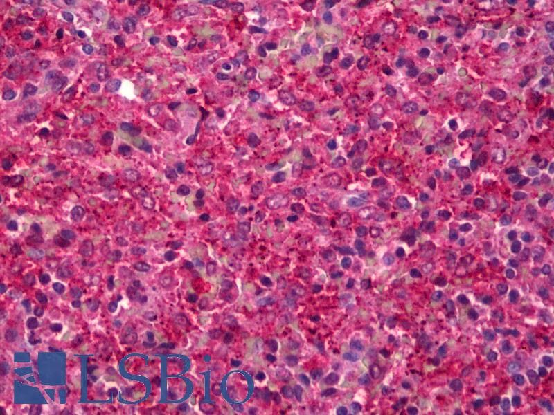 IHC-plus™ ANXA5 / Annexin V Antibody