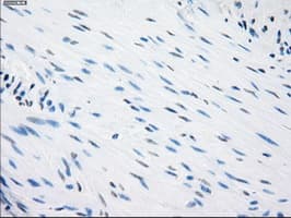CD32A Antibody (clone OTI6H7)