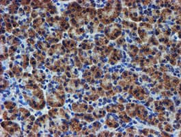 UNG / Uracil DNA Glycosylase Antibody (clone OTI1F8)