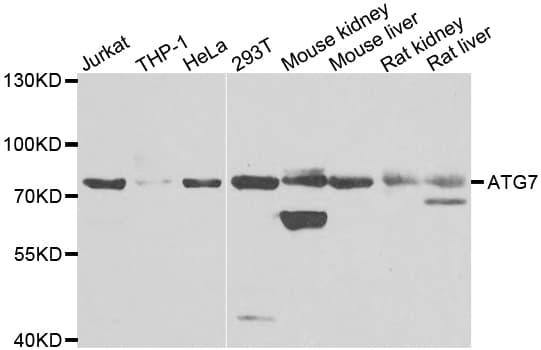 Polyclonal Rabbit anti-Human Apg7 / ATG7 Antibody (IHC, WB)