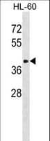 ST8SIA6 Antibody (aa138-167)