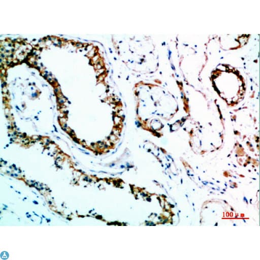 Polyclonal Rabbit anti-Human IL31 Antibody (WB)