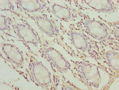 TMEM65 Antibody