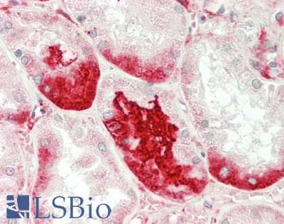 IHC-plus™ Polyclonal Rabbit anti-Human GNT-III / MGAT3 Antibody (aa72-102, IHC, WB)