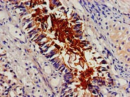Polyclonal Rabbit anti-Human BCAR1 / p130Cas Antibody (IHC, IF, WB)