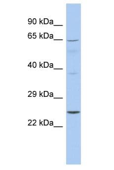 EBS / NAT9 Antibody (aa157-206)