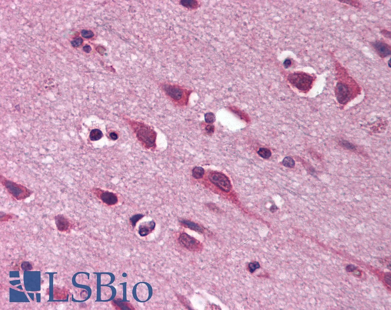 IHC-plus™ Polyclonal Rabbit anti-Human CCN3 / NOV Antibody (C-Terminus, IHC, WB)