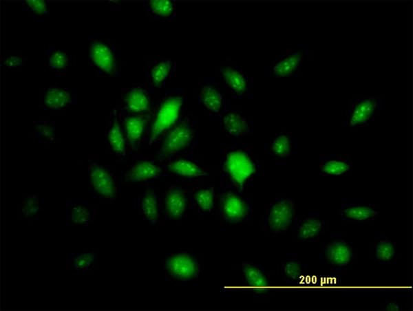 HMG20B / BRAF35 Antibody (clone 1F6)