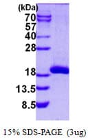 Human SAT2 Protein (Recombinant His)