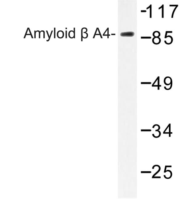 APP / Beta Amyloid Precursor Antibody (Glu737/662)