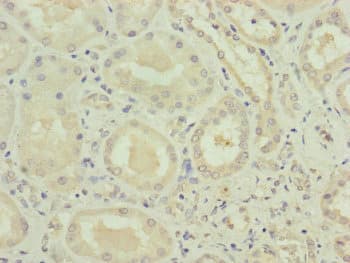 Polyclonal Rabbit anti-Human VPS11 Antibody (IHC)