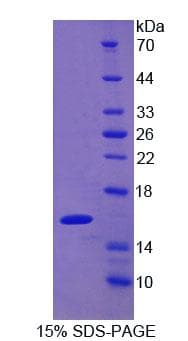 Human LGALS9C Protein (Recombinant His)