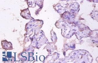 EMA / MUC1 Antibody (HRP)