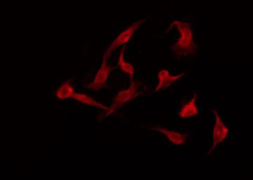 PTGER3 / EP3 Antibody