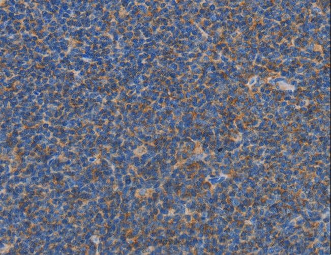 CARD6 Antibody