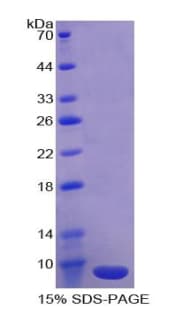 Human ADAMTS8 Protein (Recombinant His)