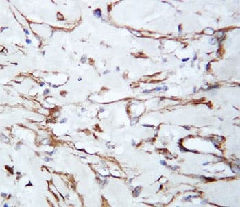 VEGFA / VEGF Antibody (aa59-74)