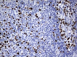 Monoclonal Mouse anti-Human MKI67 / Ki67 Antibody (clone OTI3B6, IHC)