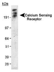 CASR/Calcium Sensing Receptor Antibody (N-Terminus, clone HL 1499, Biotin)