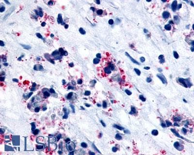 IHC-plus™ CYSLTR1 / CYSLT1 Antibody (C-Terminus)