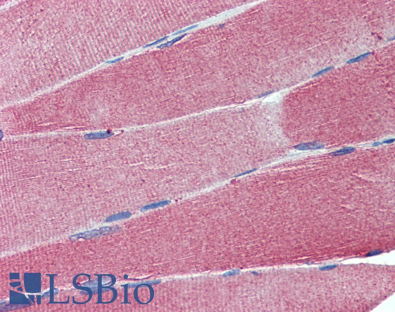 PathPlus™ IGSF4C / CADM4 Antibody (aa73-83)