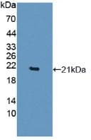 Human TNF Alpha Protein (Recombinant His, N-Terminal)