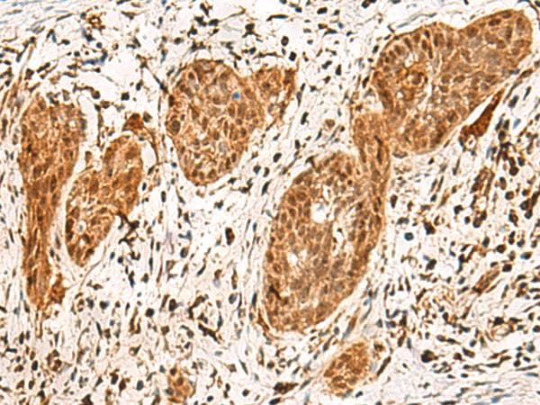 Polyclonal Rabbit anti-Human POLR1E Antibody (IHC)